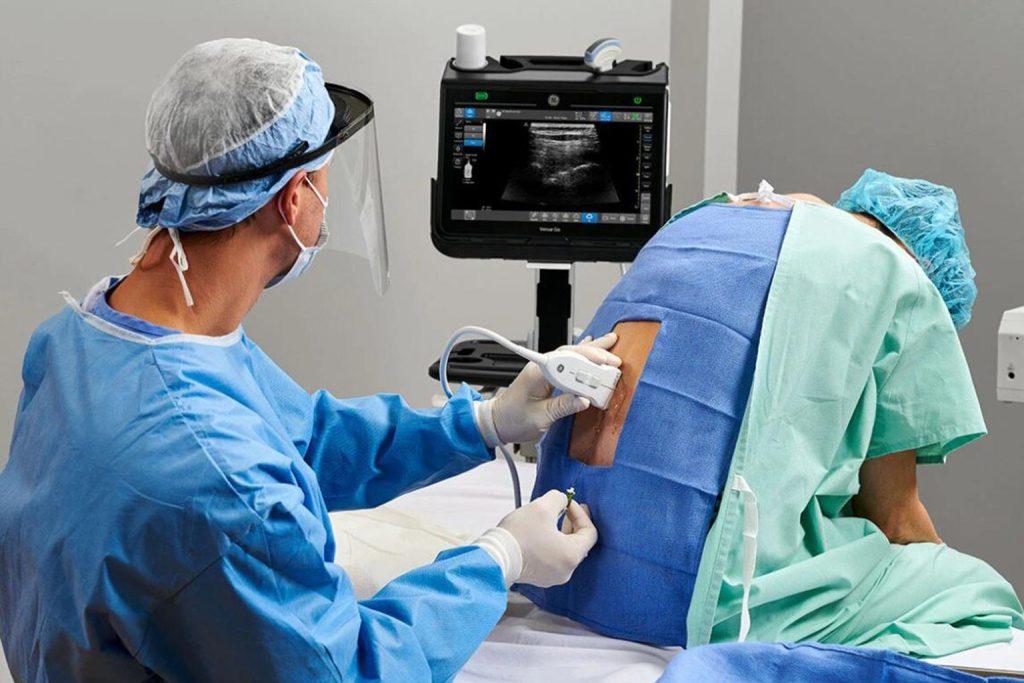 Nerve Block
